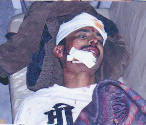 Mr. Babalu Tekale,Vice President,Shivapratishthan injured by Muslim attack