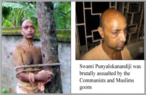 Photos of Swami Punyalokanandaji, brutally assaulted by Muslims & Communists