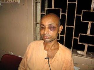 Swami Punyalokananda at the SSKM Hospital, Kolkata